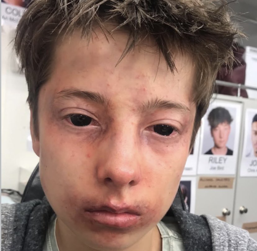 ryanwhelann's tweet photo. aigoo why do writers just making joe bird bandaged and bruised in all his projects 😭😭😭 https://t.co/wWAxq1Sa4a