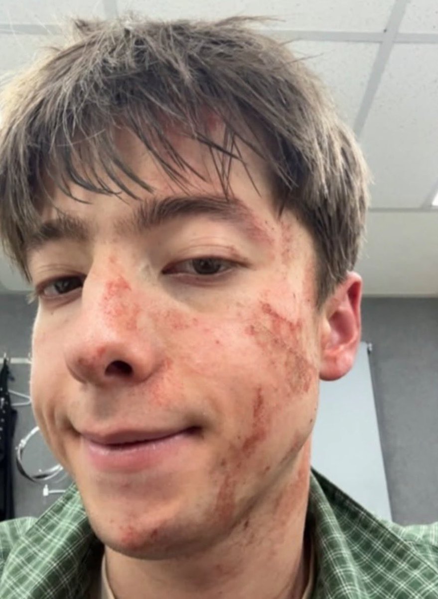 ryanwhelann's tweet photo. aigoo why do writers just making joe bird bandaged and bruised in all his projects 😭😭😭 https://t.co/wWAxq1Sa4a