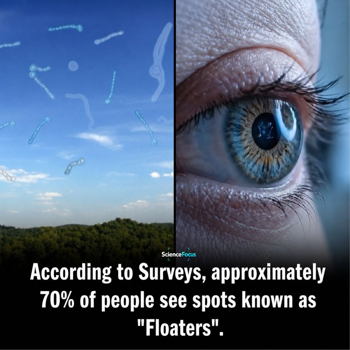 ICDeadPixels's tweet photo. Those mysterious squiggly shapes drifting across your vision aren't your imagination. They're called eye floaters and most people will notice them at some point in their lives.

Eye floaters are tiny clumps of collagen or gel inside the vitreous, the clear substance that fills the inside of your eye.

As light enters the eye, these tiny particles cast shadows on the retina, making them appear as drifting dots, threads, cobwebs, or squiggly lines that seem to move whenever you try to look directly at them.

They're often easiest to see when looking at a bright blue sky, a white wall, or a computer screen.

Floaters become more common with age as the vitreous naturally changes and becomes more liquid. They can also occur after eye injuries, nearsightedness, or certain eye conditions.

In most cases, eye floaters are completely harmless and your brain gradually learns to ignore them over time.

However, a sudden shower of new floaters, flashes of light, or a dark curtain blocking part of your vision could signal a retinal tear or detachment, which requires immediate medical attention.

Most floaters are simply a normal part of how the eye ages and while they can be annoying, they're usually nothing to worry about.