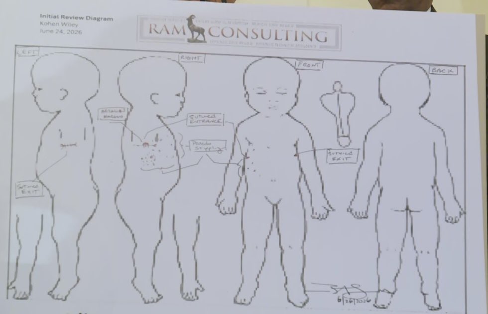 SarahisCensored's tweet photo. An independent forensic review ruled the death of one-year-old Kohen Wiley a homicide and reported that he was shot from the right side of his chest and the bullet exited through his left side. 

In the forensic review, Dr. Roger Mitchell determined that the cause of death was a gunshot wound to the torso.

I do plan on reporting on every detail as they come out.