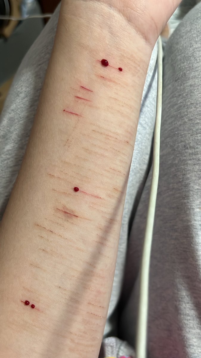 fffischys's tweet photo. Small little cuts. #slittwt #shhtwt https://t.co/Kqupdun7wE