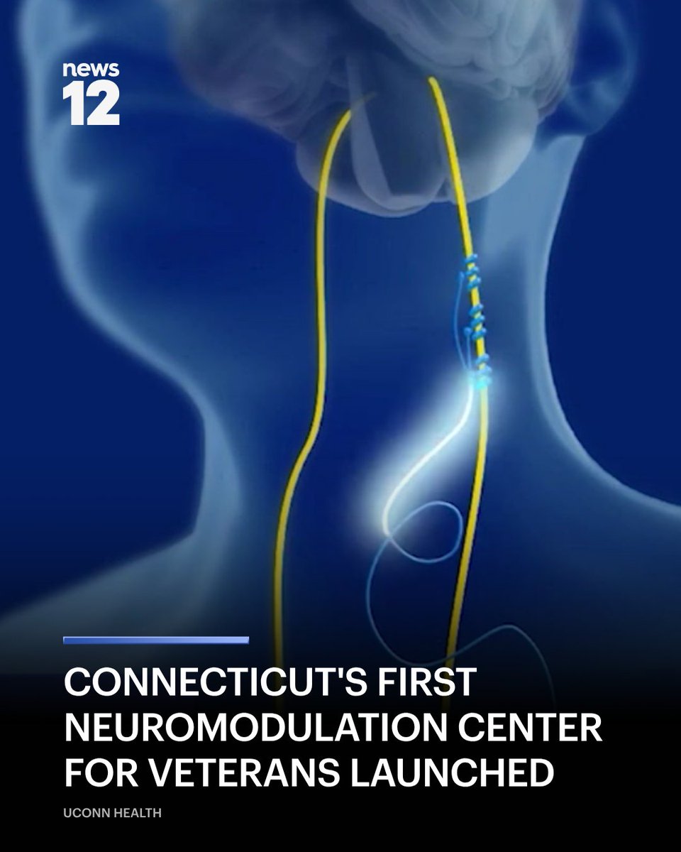 News12CT's tweet photo. VETERAN HEALTH: Connecticut veterans who are suffering from strokes and chronic pain will now have access to groundbreaking treatment. 
#News12 #Connecticut #UCONN
https://t.co/Iyw3QHO82q https://t.co/2187N0IWi2