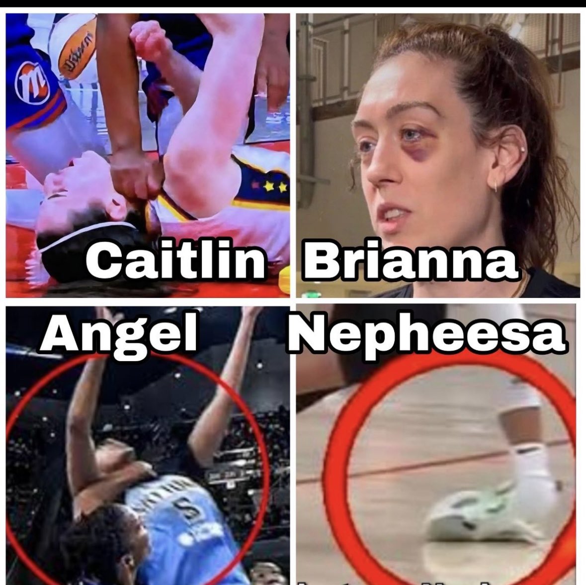 davi60605's tweet photo. @DataScience1856 @CLG98264897 This woman is a danger to every player on the court &amp; she wants to make it about race, to run away from accountability, but it isn’t. She actually injured some players worse than she has CC. https://t.co/TdKvpwux8n