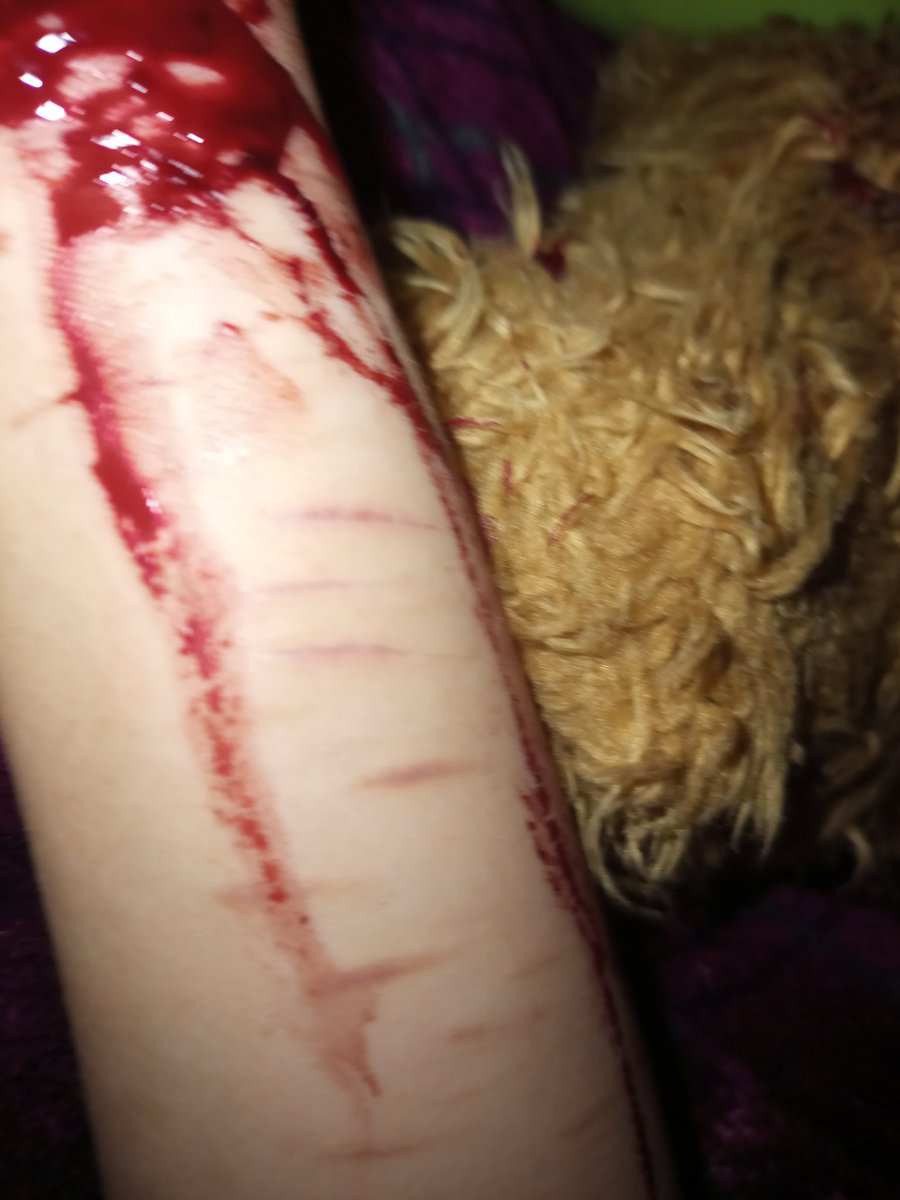 Tysonnsamm's tweet photo. Trate de quitarme la vida y no funcionó jeje https://t.co/ZdemNnsKpK