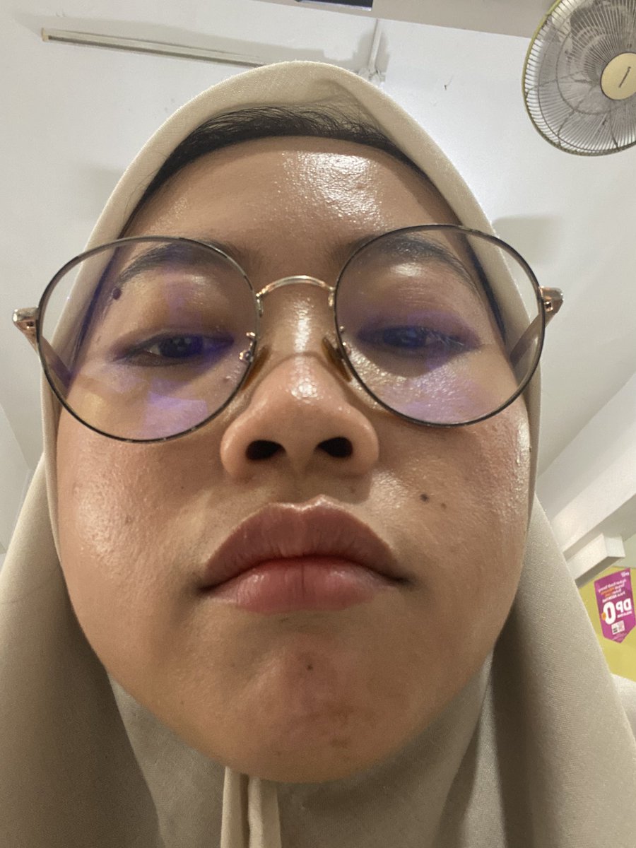 guxmmyy's tweet photo. Gak suka banget kalo mau flu gini. https://t.co/mib0Je5TvQ