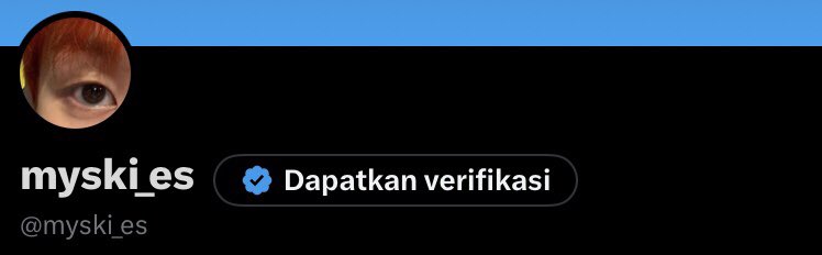 myski_es's tweet photo. @shimourii maap orange gee di lengserkan dulu, pp cimoy lebih menggambarkan perasaan ku saat inihh 💔🤧😭 https://t.co/tr0Lx7H4uh
