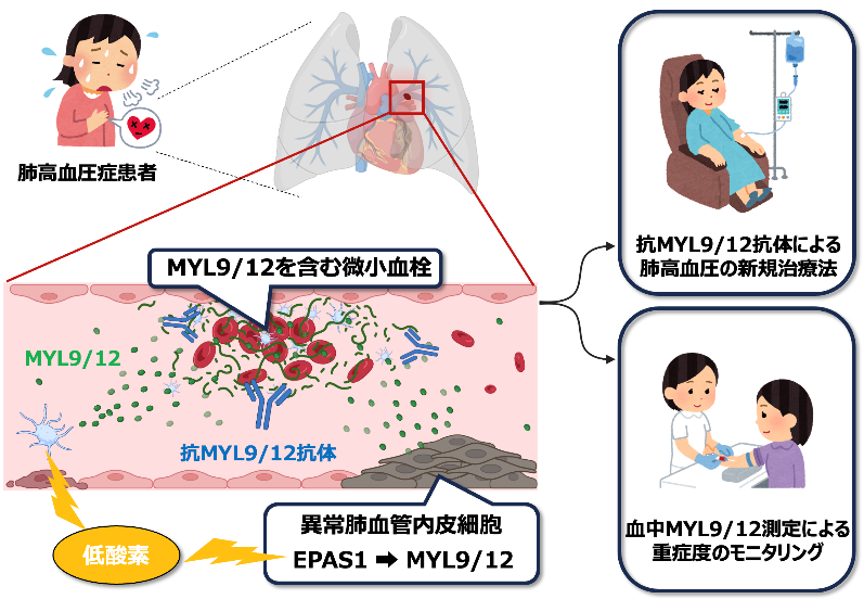 cSIMVa_JP's tweet photo. MYL9/12と呼ばれるタンパク質が難治性疾患「肺高血圧症」における、①治療標的に成り得ること、②疾患の重症度を測定する有用なバイオマーカー(評価指標)成り得ることを発見しました。
https://t.co/9yB4VQ5iSe https://t.co/odiW21FB3L