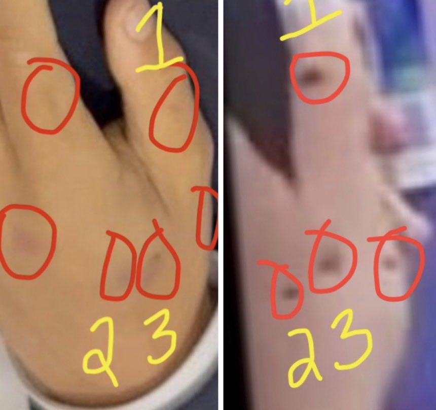 pushbackdu's tweet photo. @ArtifexMemor @ThaRhymeKing Wait until you see his hand injuries from the bomb explosion. It’s not blood spatter because they would’ve been wiped off - and the injuries are still there when he is in the coffin. https://t.co/l4VKWvipab