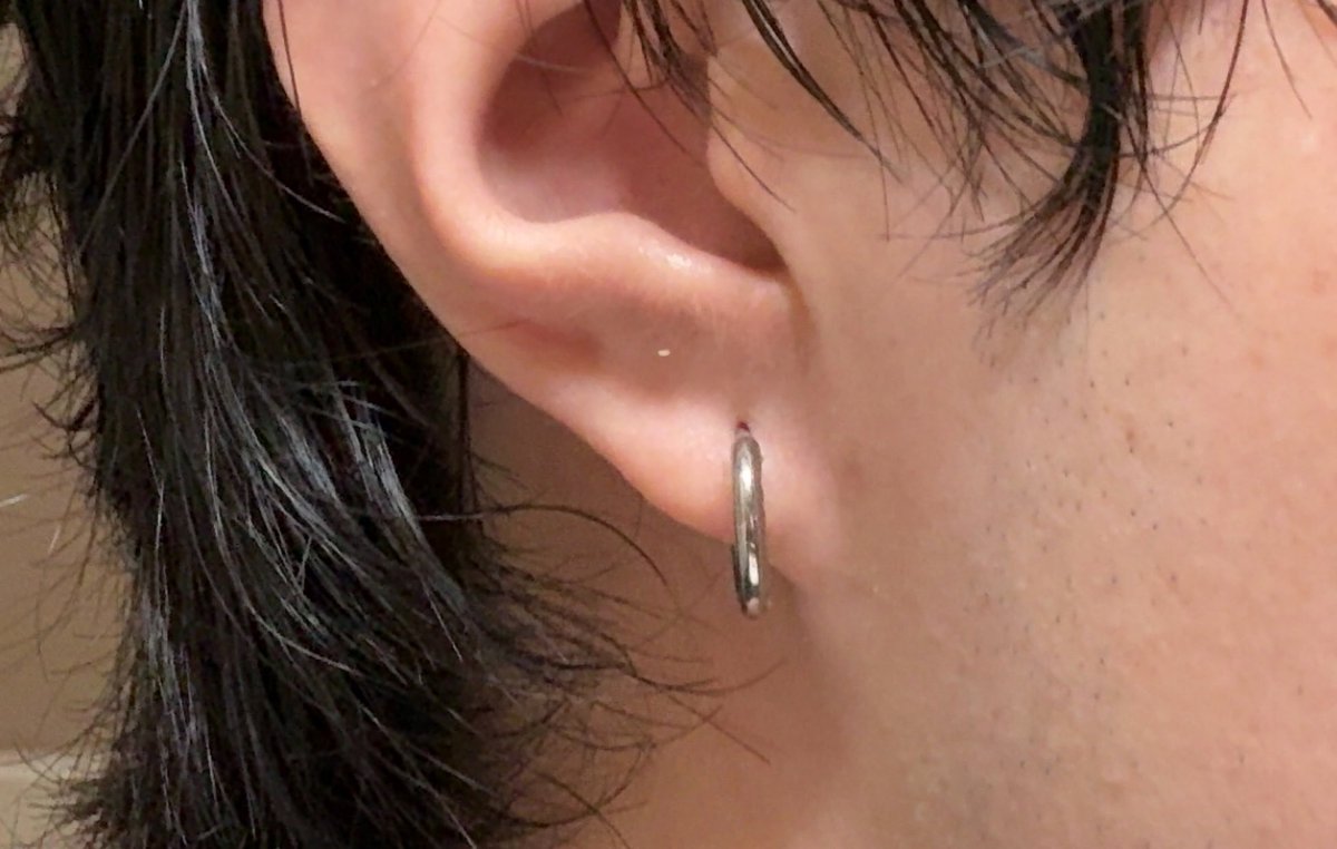SHOULD I BE CONCERNED WHY IS MY PIERCING HOLE LIKE DROPPING A BIT. I ...