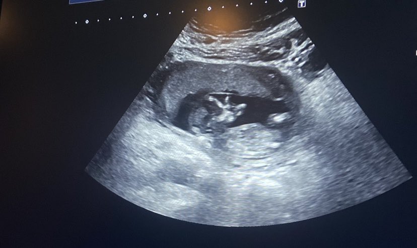 _llandolfi_'s tweet photo. I’ve been keeping a secret 😌 feeling so very blessed &amp; more excited than anything 🙏🧸 https://t.co/oM8BixUTH4