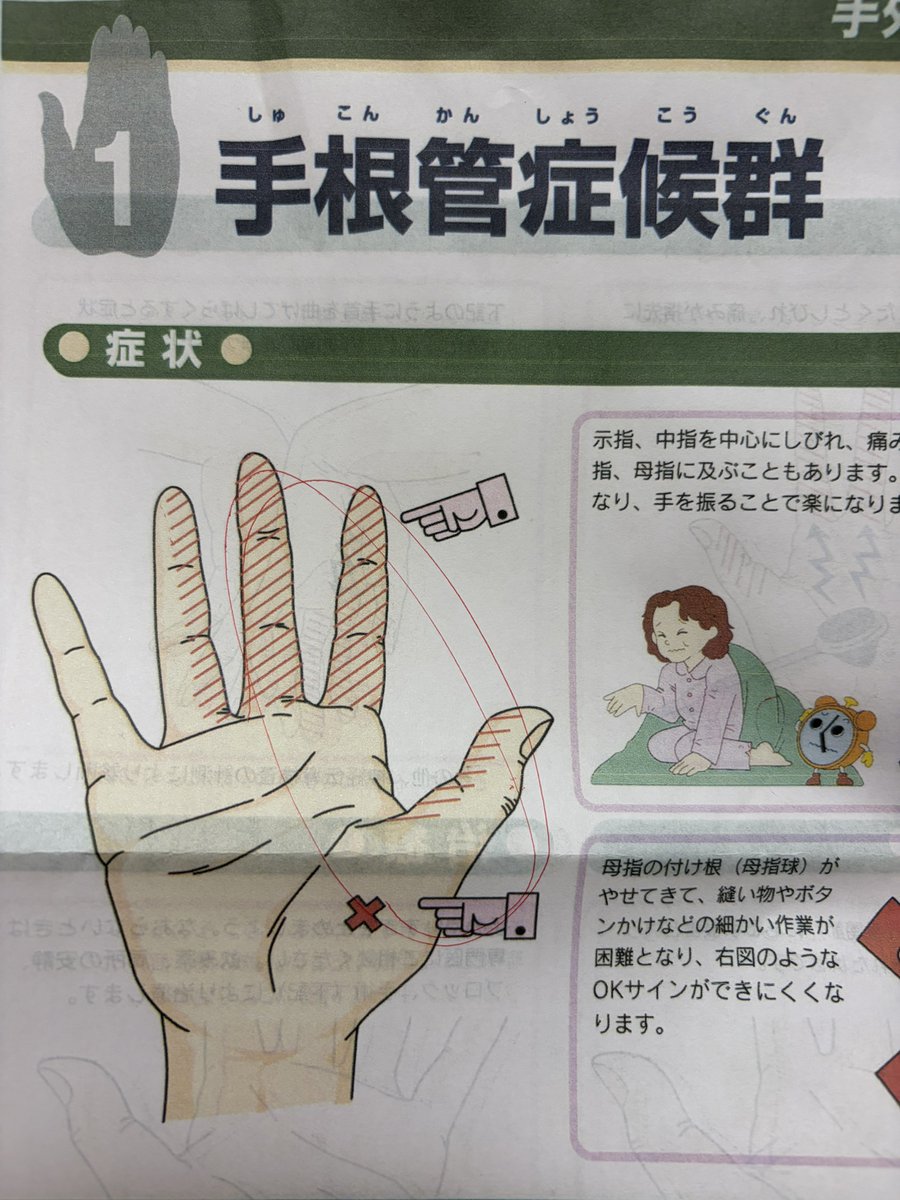 mk165cm's tweet photo. おそらくこれだろうと！
ビタミン剤で様子見！
良くなるまで左手でスマホはなるべくもたない！
運動制限は特にないけど、腕立て伏せとか神経圧迫しそうなやつは× https://t.co/0BHrWiXWML