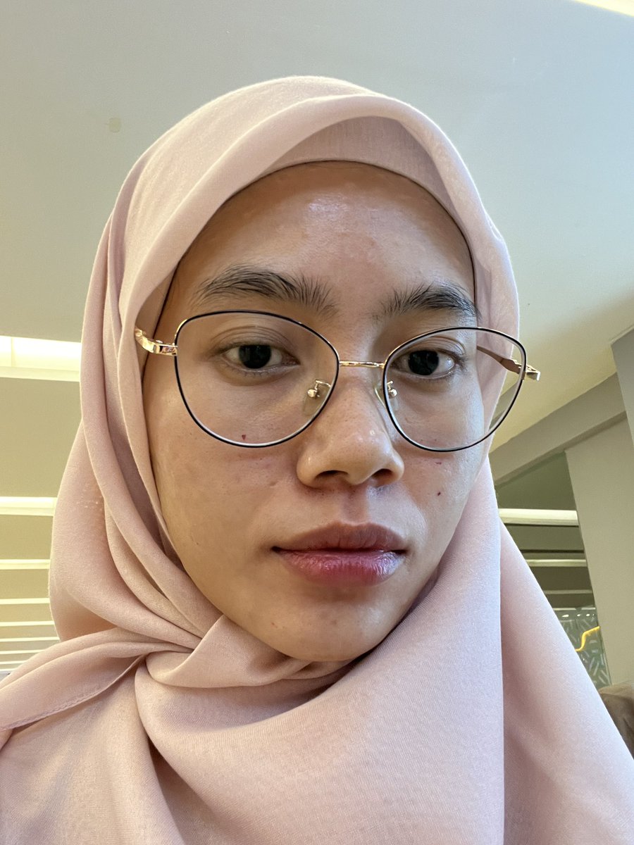 irwanyns's tweet photo. Gak jadi nyesel, ini malah jadi treatment ter-WORTH IT yg pernah kucoba!! Hydra glow skin booster with DNA salmon cuma 1jtaan, tpi hasilnya bikin bareface-ku seglowing ini 🥹✨

After treatment                  H+7 treatment https://t.co/ESBDN0htxP