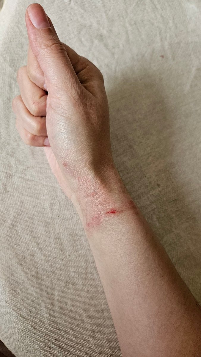 REiyoko's tweet photo. Мда. Пора продолжить спать сон по восемь часов, есть перед выходом на улицу и не нервничать так сильно.
Это вы еще мою ногу не видели Х) https://t.co/KNrgiqE30H