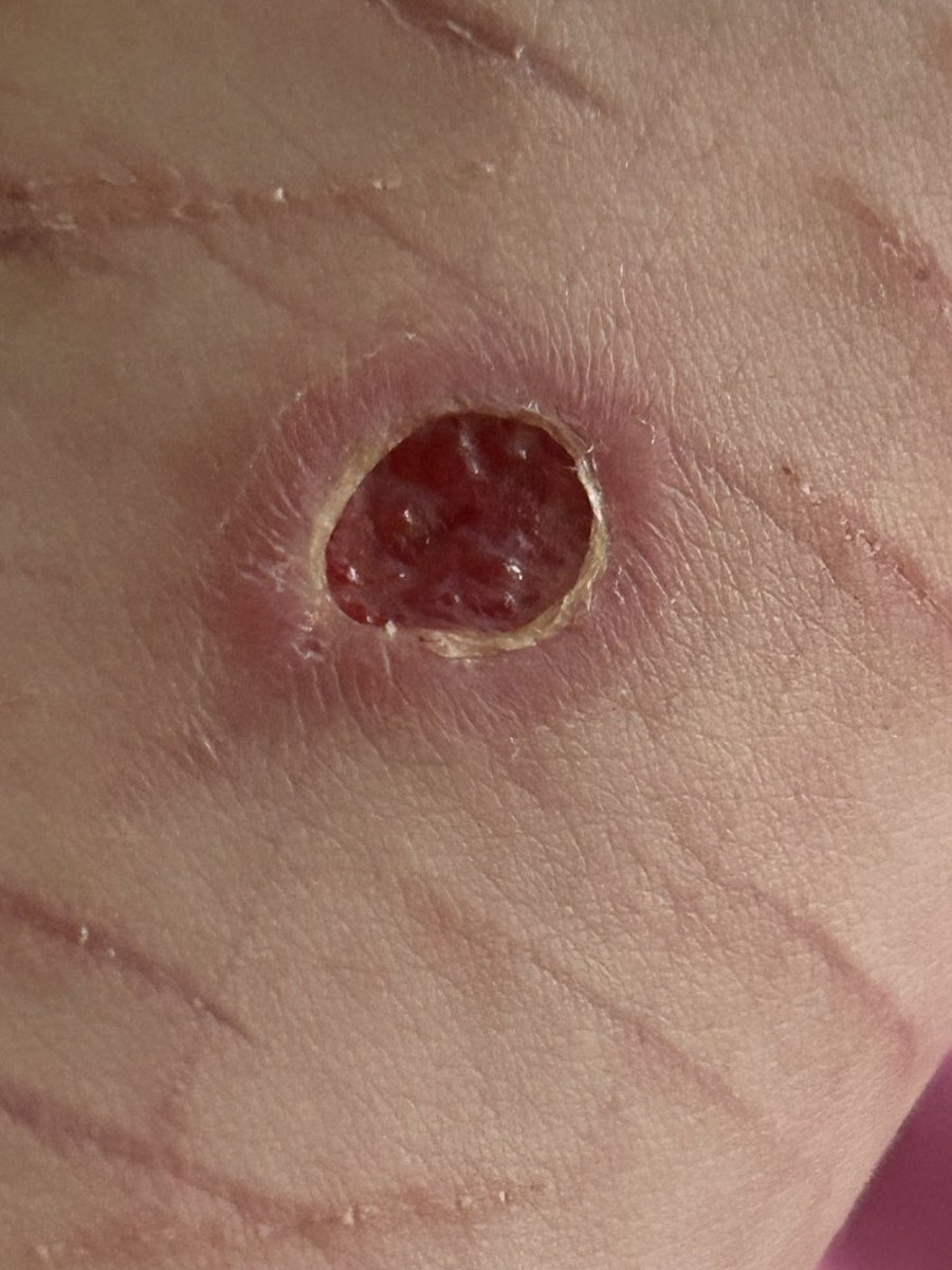 katynox44's tweet photo. Old photo but what layer is this?
TW!! ⚠️⚠️
(It’s a burn) #shedrtwt #shrtwt #slitrtwt #slittertwt https://t.co/1EuwlZ7Wln