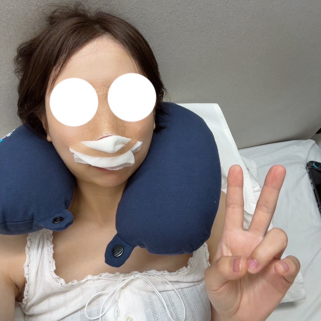 _sayaaarin's tweet photo. 無事終わりました🇰🇷
#鼻整形
#自家軟骨 https://t.co/IO2qTLvfR6