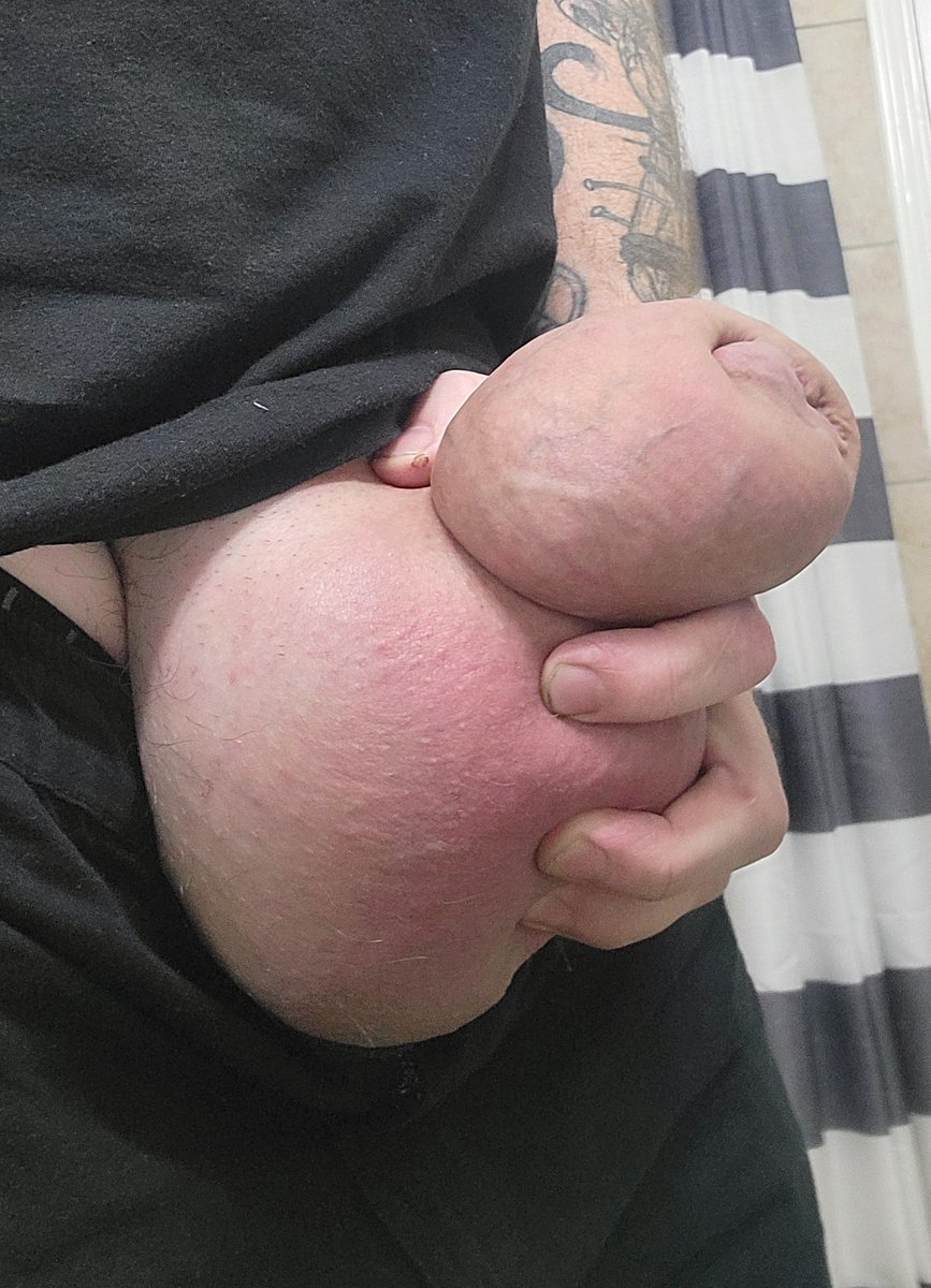 phobosmoon1987's tweet photo. Before and after results from pumping last weekend. Got a bigger tube after filling my 3.5 inch tube. Gunna try to fill the new one tonight 😈😈😈 crazy amount of growth from a few hours. What do you guys think. 🤤😵‍💫😵🤯 https://t.co/qs9xqwm4jx