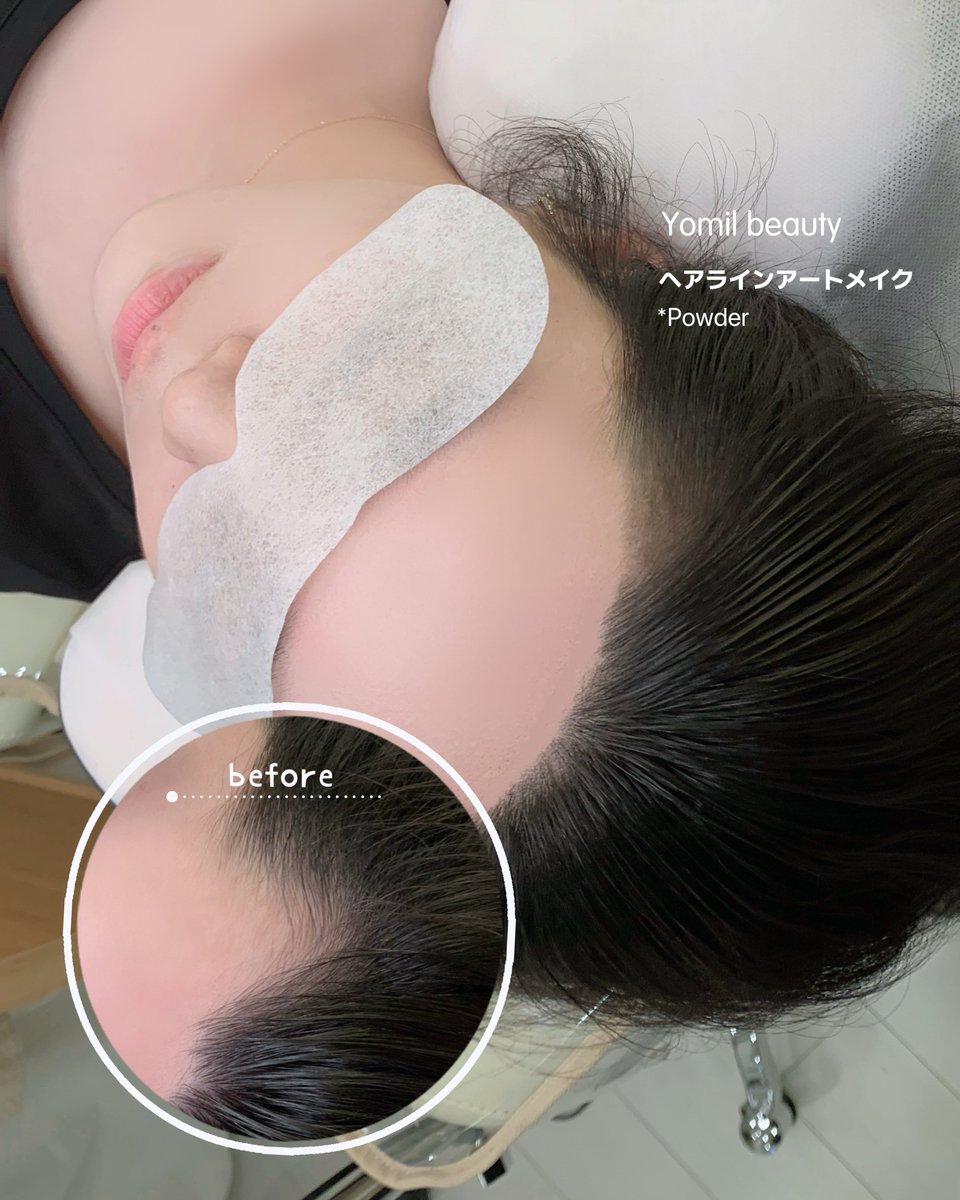 Yomil__artmake's tweet photo. ヘアラインアートメイク(パウダー技法)は生え際の隙間や透け感が気になる部分に、細かなドットを重ねて自然な密度をプラスする技法です✨

髪の毛を描き足すのではなく、頭皮の透け感を自然にカバーすることで、生え際がより自然で美しく見える仕上がりになります。

#韓国トレンド情報 #江南メイク https://t.co/j0WdWlq2G3