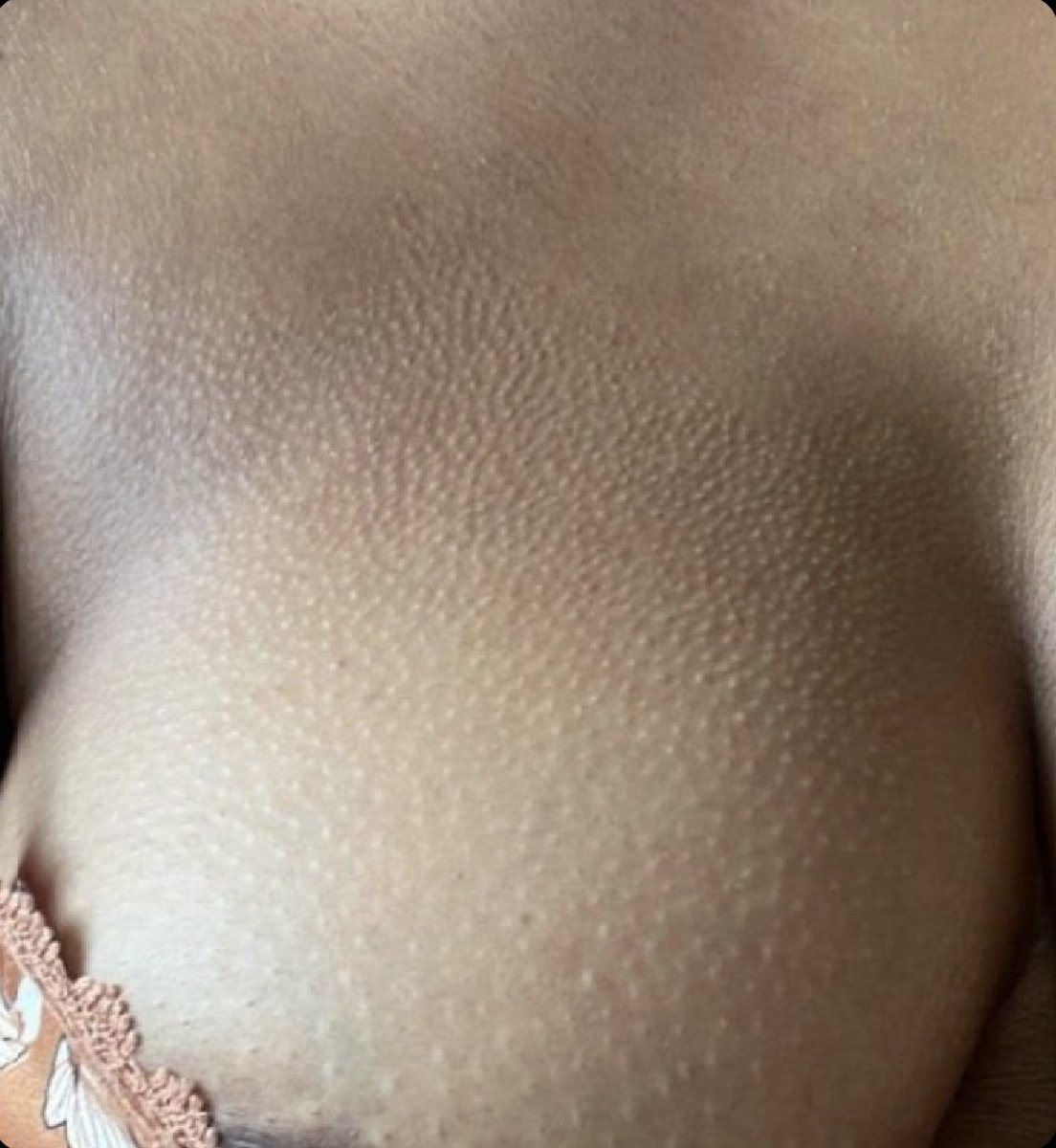 Iam_kuria1's tweet photo. Dem wa murima akiona umechorwa tattoo ya waru kwa chest😂 https://t.co/ep1TCRjhRz