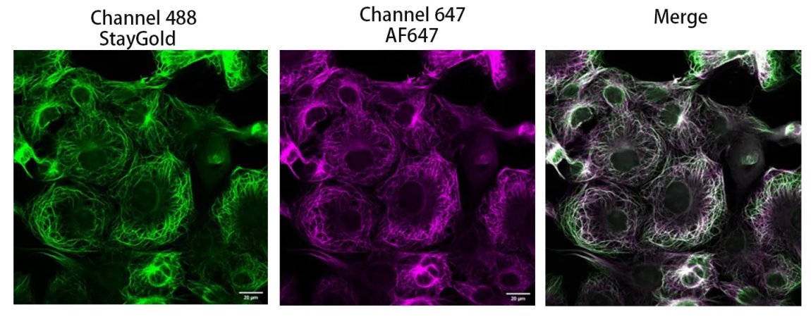 AlpVHHs's tweet photo. Zero Background. Maximum Signal. ✨
Anti-StayGold/mBaojin Rabbit Antibody combines a ~15 kDa #VHH #Nanobody with engineered Rabbit Fc to eliminate Fc receptor background, avoid cross-linking, and improve epitope access. Recognizes #StayGold, #mStayGold, mBaojin &amp; mutants.
#ICC https://t.co/XganvD6Bvh