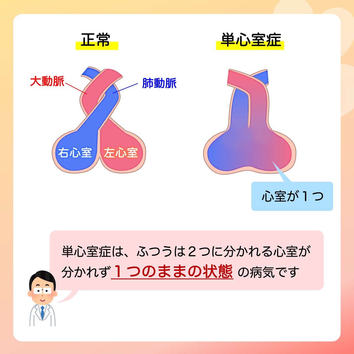 JSPCCS's tweet photo. 【公式Instagramより】

日本小児循環器学会です☺️
ㅤ
❤️子どもの心臓病の解説 ❤️ㅤ
ㅤ
＼どうして病気の種類がたくさんあるの？／ㅤ
ㅤ
先天性心疾患の病気の種類はとてもたくさんありますが、ㅤ
どうしてたくさんあるのでしょうか？ㅤ
ㅤ
先天性心疾患についてもっと知りたい！と思ったら、ㅤ
♡･････♡･････♡･････♡･････♡･････♡　ㅤ
日本小児循環器学会一般向けホームページ　ㅤ
https://t.co/0FNBjqreF9　ㅤ
をご覧ください！　ㅤ
♡･････♡･････♡･････♡･････♡･････♡ㅤ
ㅤ
♡ Instagram ♡　ㅤ
https://t.co/5jEymTDH6K　ㅤ
よかったらInstagramもフォローをお願いします！　ㅤ

#子どもの病気　ㅤ
#先天性心疾患　ㅤ
#子どもの心臓病　ㅤ
#心臓の発生　ㅤ
#日本小児循環器学会