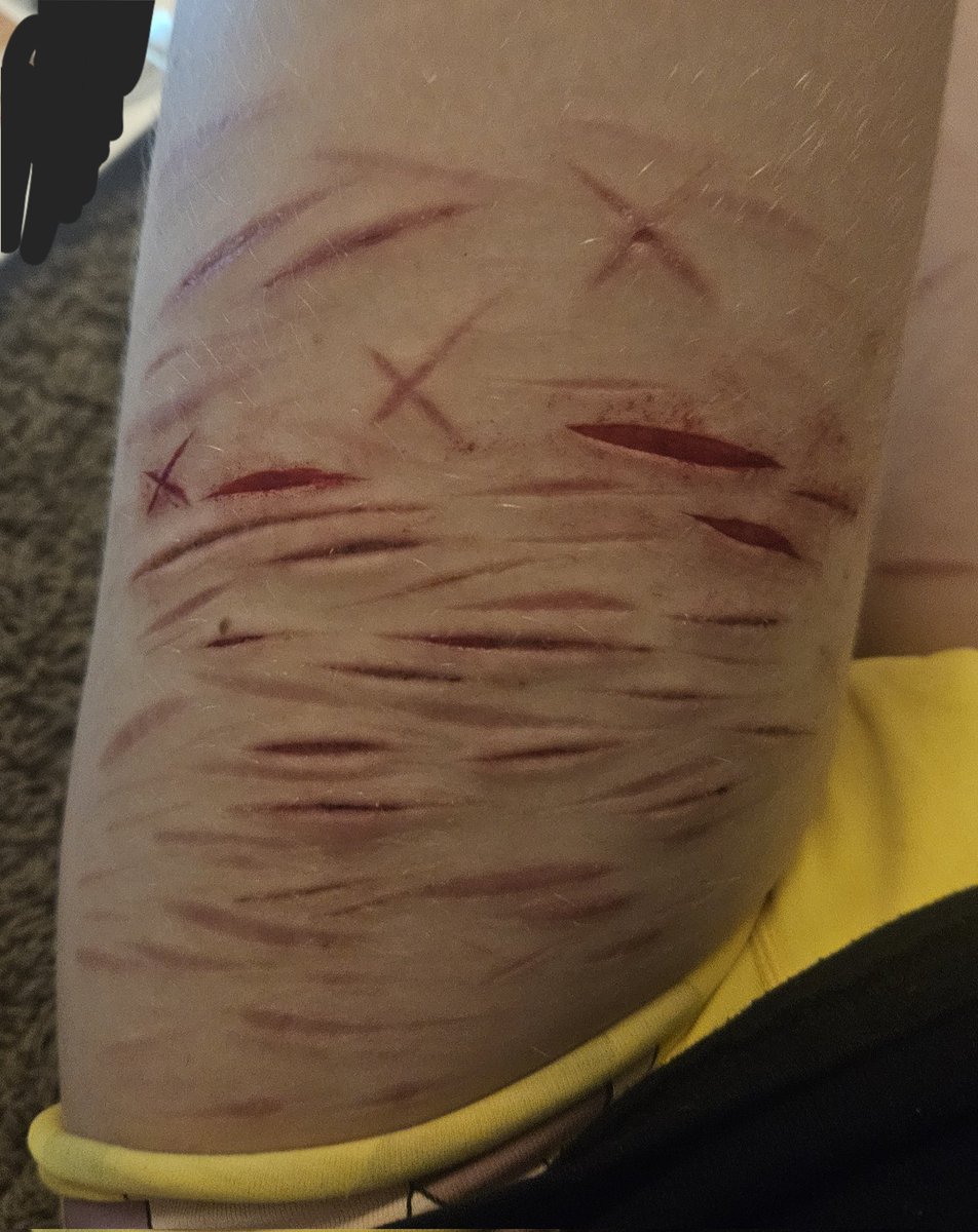 take1taway's tweet photo. Thigh #sfxmakeup practice deep styro / baby beans
ALL SFX MAKEUP AI GENERATED FAKE BLOOD!!
#shtwt #slittwt #ouchietwt #cutspo https://t.co/L8MKTyiH6N