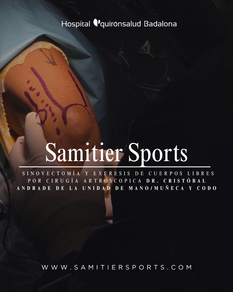 Samitiersports's tweet photo. Dr. Cristobal Andrade  de la Unidad de Mano/Muñeca y codo de Samitier Sports, realizando una cirugía de Sinovectomía  y exeresis de cuerpos libres por artroscopia en @quironsalud Badalona.
#lesioncodo #deporte #codo #basketball https://t.co/LatwLKNvgB