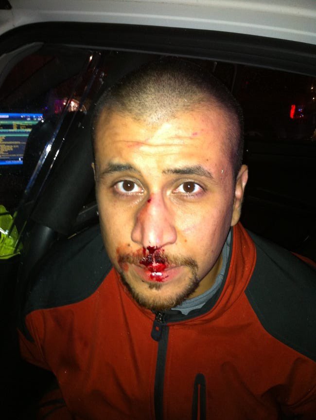 ransom0187's tweet photo. @SagKyngTyrius @SeharaNatural @RT_com Trayvon Martin was on top of Zimmerman brutally bashing his head into concrete after breaking his nose

Again, Trayvon was shot while on top of Zimmerman.. during the act of bashing his head into concrete https://t.co/iTtYgvVrQp