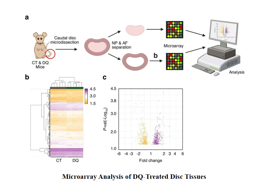 BoneRes_Office's tweet photo. In #mouse experiments, a drug combo called #DQ clears out aging cells in spinal discs, easing #degeneration and #fibrosis. The same cell-cleanup approach worked in human disc cells too, pointing to a new way to slow chronic back pain and potentially reduce the need for #surgery.👍
@BoneRes_Office 
@RutejaBarve 
https://t.co/DJ4kamereE