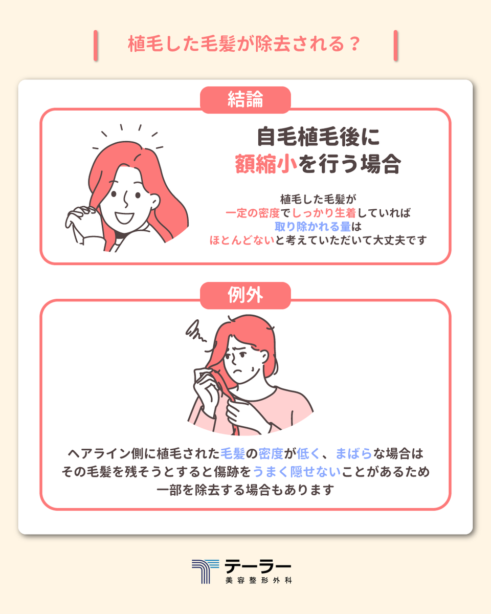 TAILORPS1's tweet photo. ✨テーラー美容外科✨

今回は
「額縮小と自毛植毛」の順番や疑問について
それぞれ気をつけるポイントを交えながら
分かりやすく解説しました！

✅額縮小の後の自毛植毛は可能？
✅傷跡への植毛は生着率が落ちる？
✅植毛後に額縮小をすると移植した毛はどうなる？

🔗詳しくはアメブロで❣️
https://t.co/yCrDbPBmpN📎

今後も手術に関する情報を
わかりやすくまとめていく予定ですので
是非、コメントやフォローもよろしくお願いいたします💕

#額縮小
#自毛植毛
#小顔
#渡韓整形
#テーラー美容外科