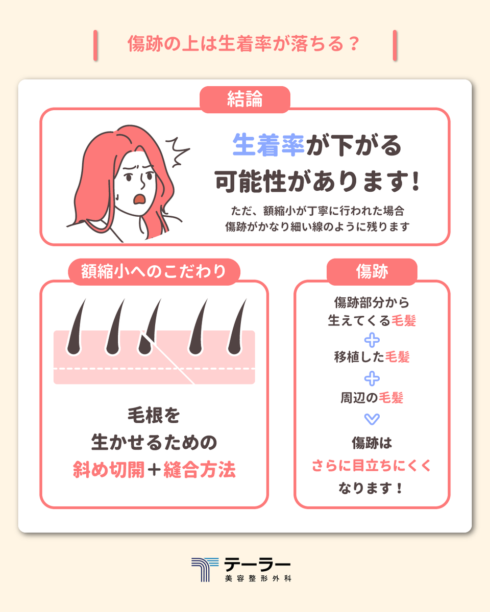TAILORPS1's tweet photo. ✨テーラー美容外科✨

今回は
「額縮小と自毛植毛」の順番や疑問について
それぞれ気をつけるポイントを交えながら
分かりやすく解説しました！

✅額縮小の後の自毛植毛は可能？
✅傷跡への植毛は生着率が落ちる？
✅植毛後に額縮小をすると移植した毛はどうなる？

🔗詳しくはアメブロで❣️
https://t.co/yCrDbPBmpN📎

今後も手術に関する情報を
わかりやすくまとめていく予定ですので
是非、コメントやフォローもよろしくお願いいたします💕

#額縮小
#自毛植毛
#小顔
#渡韓整形
#テーラー美容外科