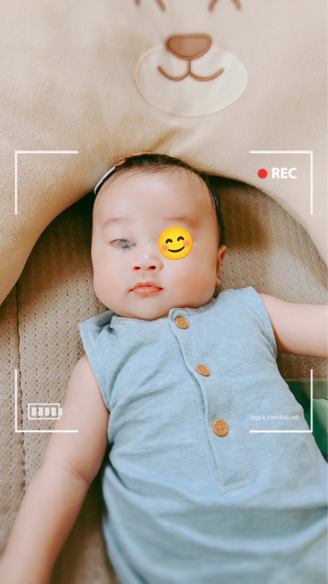 crazytiger911's tweet photo. 今日で3ヶ月👶🏻

おしゃべりがじょうずになりました((˙ࠏ˙))ｱｩｰｰｰ
お出かけすると色んな方たちに大きいねぇって言われてますねﾃﾞｶｰ - ̗̀ ( ˶'ᵕ'˶) ̖́- ｰｲ!!!!

家族みんなのおかげで元気いっぱいです

ありがとう😄 https://t.co/qGpuhN5JHM