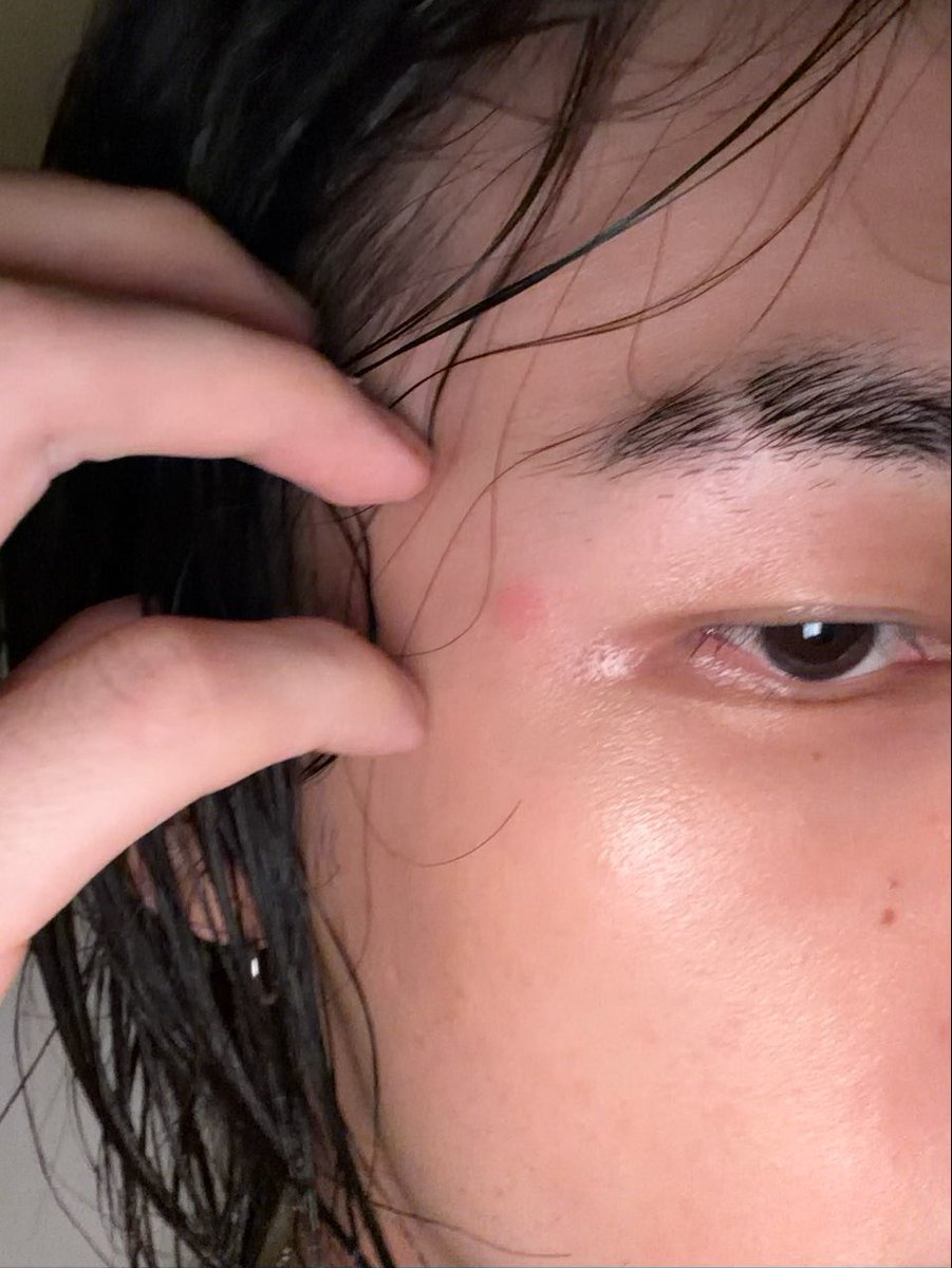 havenfiIm's tweet photo. 🥟🫧

: i want to stop talking about mosquitoes
: i really want to stop talking about mosquitos but there’s an update
: it kissed me on the forehead
: it’s just so itchy i could d!e https://t.co/9KgqhrvRj1