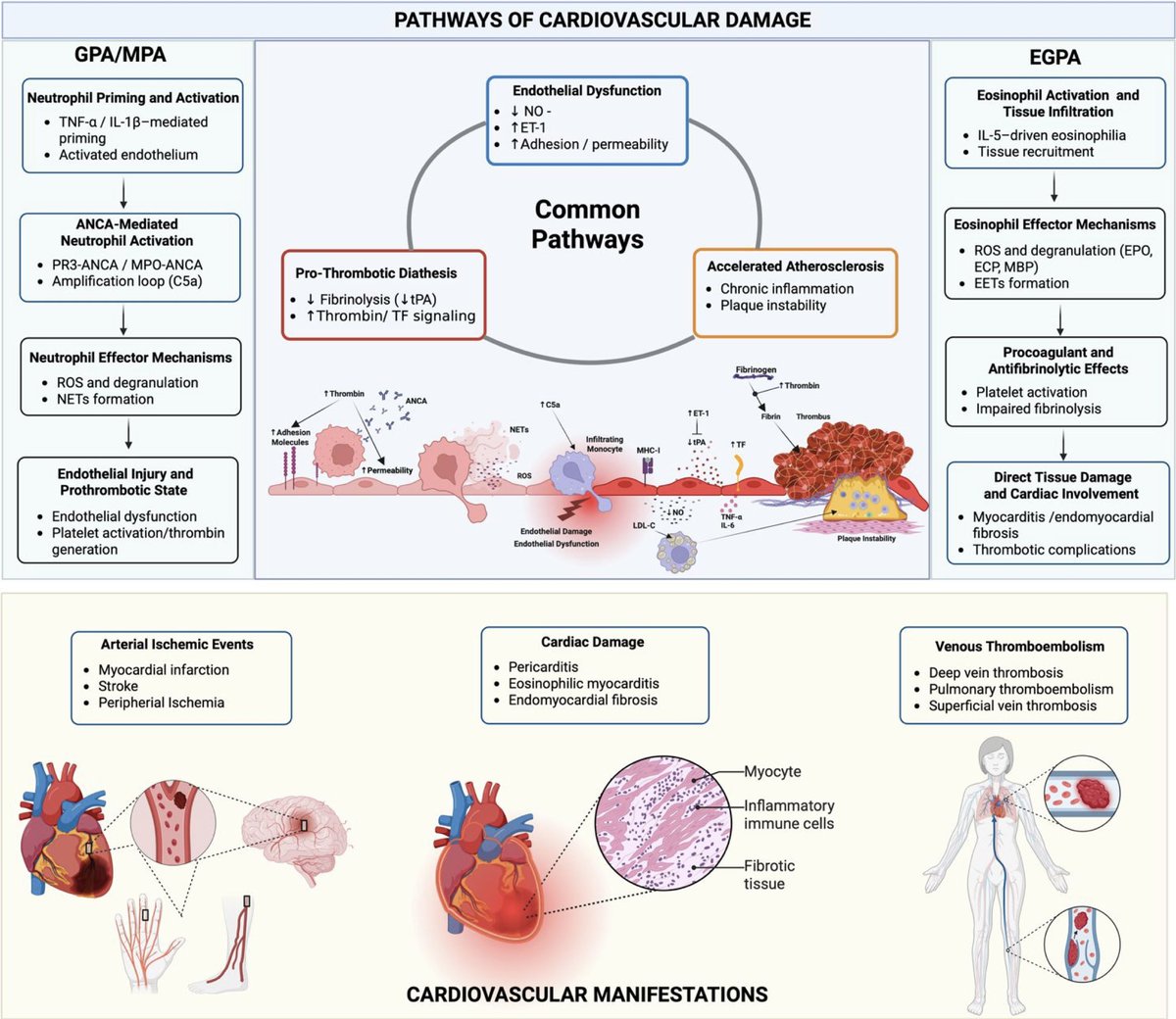 Vasculitis_Lund's tweet photo. New publication!
#AAV patients have a markedly increased risk of cardiovascular disease &amp; thrombosis, driven by inflammation, traditional CV risk factors and treatment-related toxicity. 
DOI: 10.1093/rheumatology/keag268 https://t.co/bvvFpVL8MX