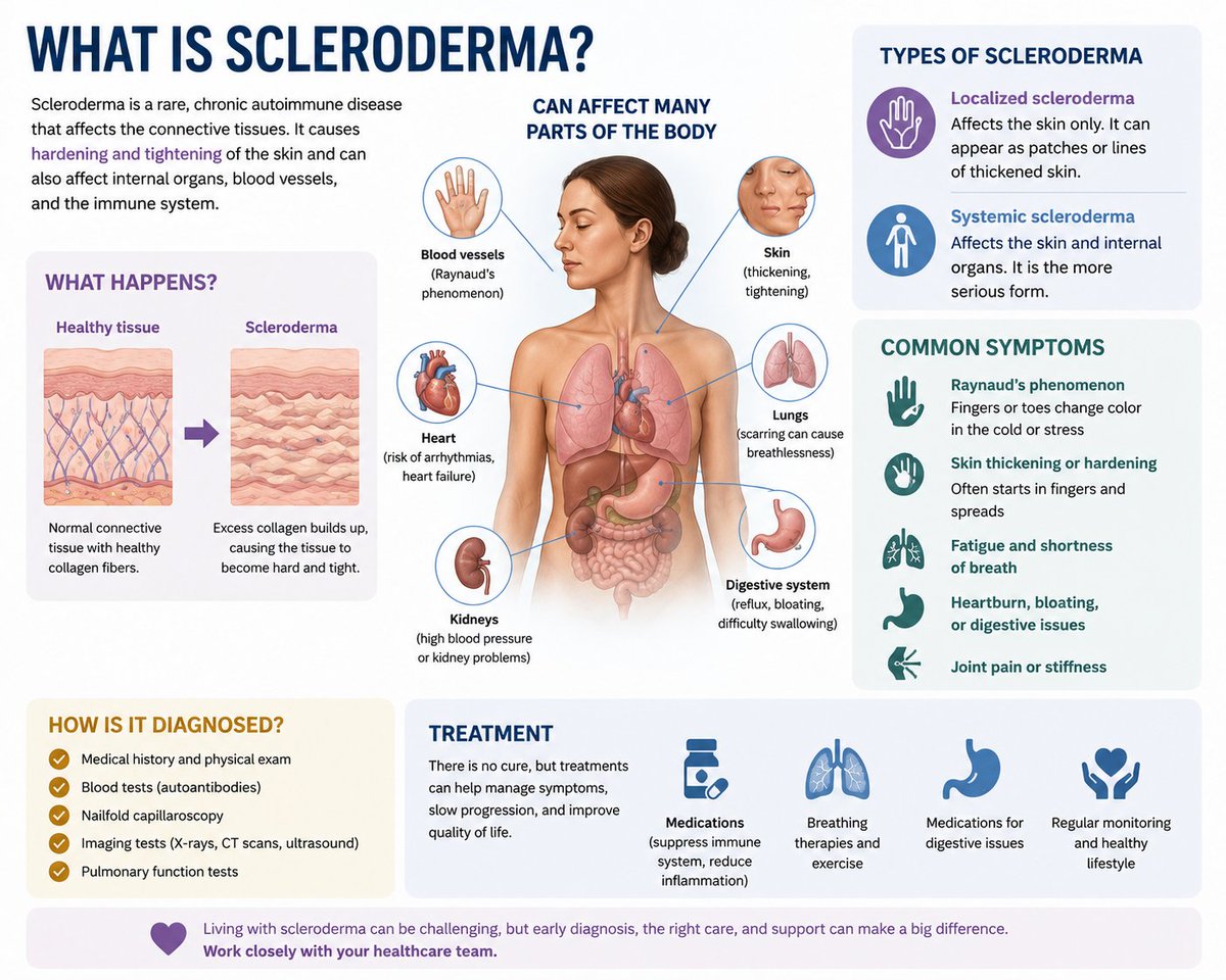 VivaHealthyLife's tweet photo. Scleroderma: Causes, Symptoms, and Holistic Management
Scleroderma is most commonly known as Systemic Sclerosis (or SSc) when it affects the whole body. Other names for the condition include... Read more: https://t.co/sG6E5Lc86G #SS #scleroderma #Systemicsclerosis #holistic https://t.co/d0tHKq7EGT