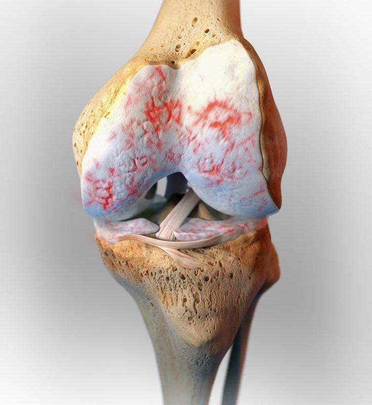 nutri_henry's tweet photo. Your bones don’t store calcium just for themselves.

They’re your body’s calcium bank.

When your diet doesn’t provide enough calcium, your body withdraws from that bank to keep your muscles, nerves and heart working.

The withdrawals add up.

#BackToTheOrigin
#NutritionistHenry https://t.co/lsA5axLot6