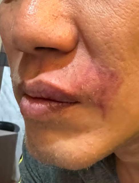 LexWu_13's tweet photo. Percuma @PolrestabesSby pencitraan pakai penghargaan Presiden @prabowo . tapi penyampaian Presiden dalam penegakkan hukum aja gk bisa.
kanda @ListyoSigitP ini ex napi yg suruh anak kecil menggonggong, bebas bersyarat! stlh bebas, arogansinya tetap! aniaya orang! kasus diem ditmpt https://t.co/AgPEvzVHz6