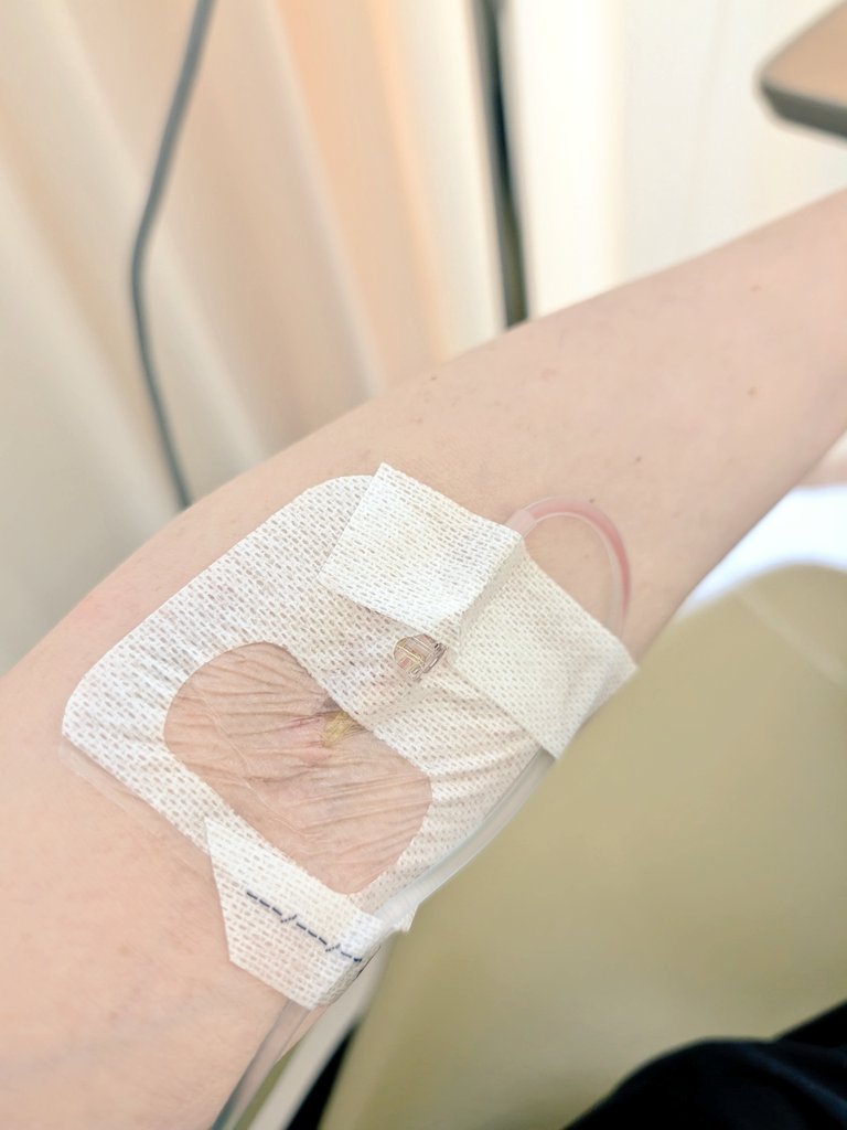 tome0938's tweet photo. 今日は通院日で 外来受診をして来た🏥
膠原病内科と 腎臓高血圧内科と 整形外科
それに加えて今回は
１年継続中の骨粗鬆症 治療の折り返しなので
半年ごとの骨塩定量検もあり
放射線科も含めて計４科💦

いつも通りサフネローの点滴と
イベニティの皮下注射をして来た

骨密度は 少し上がって40だった https://t.co/yLiC7lrWGD