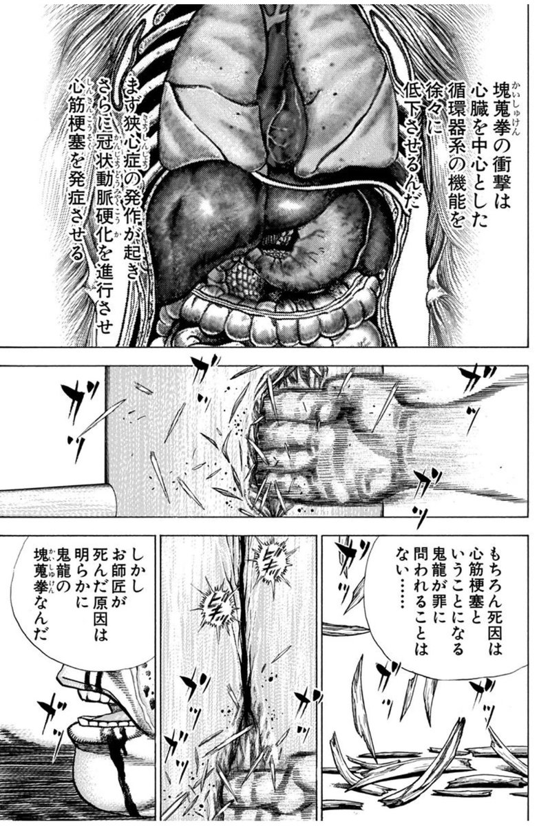 Tarohi181's tweet photo. 塊蒐拳による循環器系の機能障害

『対象を五年かけて殺す技による病変』と書けばそれまでだが作中描写を見ると
・現代医療では対症療法すら無理
・受けた瞬間から肉体が蝕まれる
ことから、絶え間ない苦痛と死への恐怖に五年間苛まれながら絶命するしかない病気なんだ
満足か？ https://t.co/i4ZeFlIlks