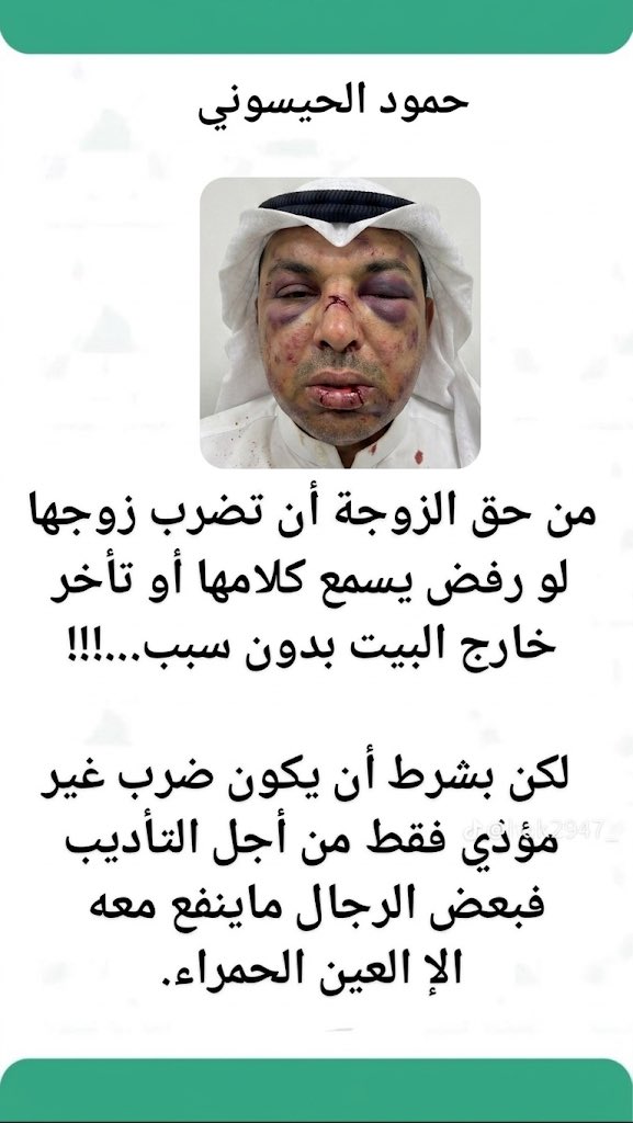 almistro_201's tweet photo. @MARIAM_Albabtan اتفق معه https://t.co/KmIIqfFh8j