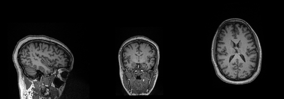 CarrieJohnson_E's tweet photo. A new way, I am dealing with stupid people. Here my brain &amp; stomach images from a MGH clinical research study. Clinical Research Title: Modulation of Gastric Sensitivity and Accommodation by Vagal Nerve Stimulation, Mass General Hospital -Principal Investigator: Braden Kuo, MD. https://t.co/ChetAV4Ywy