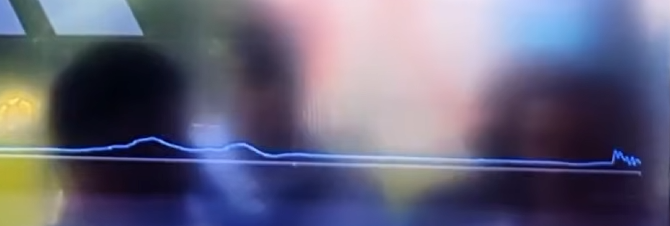 firminothethird's tweet photo. @thedukeofmadrid Guys talk too much, they analize the touch of Croatia player not the Portuguese! Thats a light touch. Head punch would be bigger more like a "Spike"! Check this video and draw your own conclusions! https://t.co/ynZ1GZBEev
Too many "smart" people that dont even understand sensors! https://t.co/G44zovHD1U