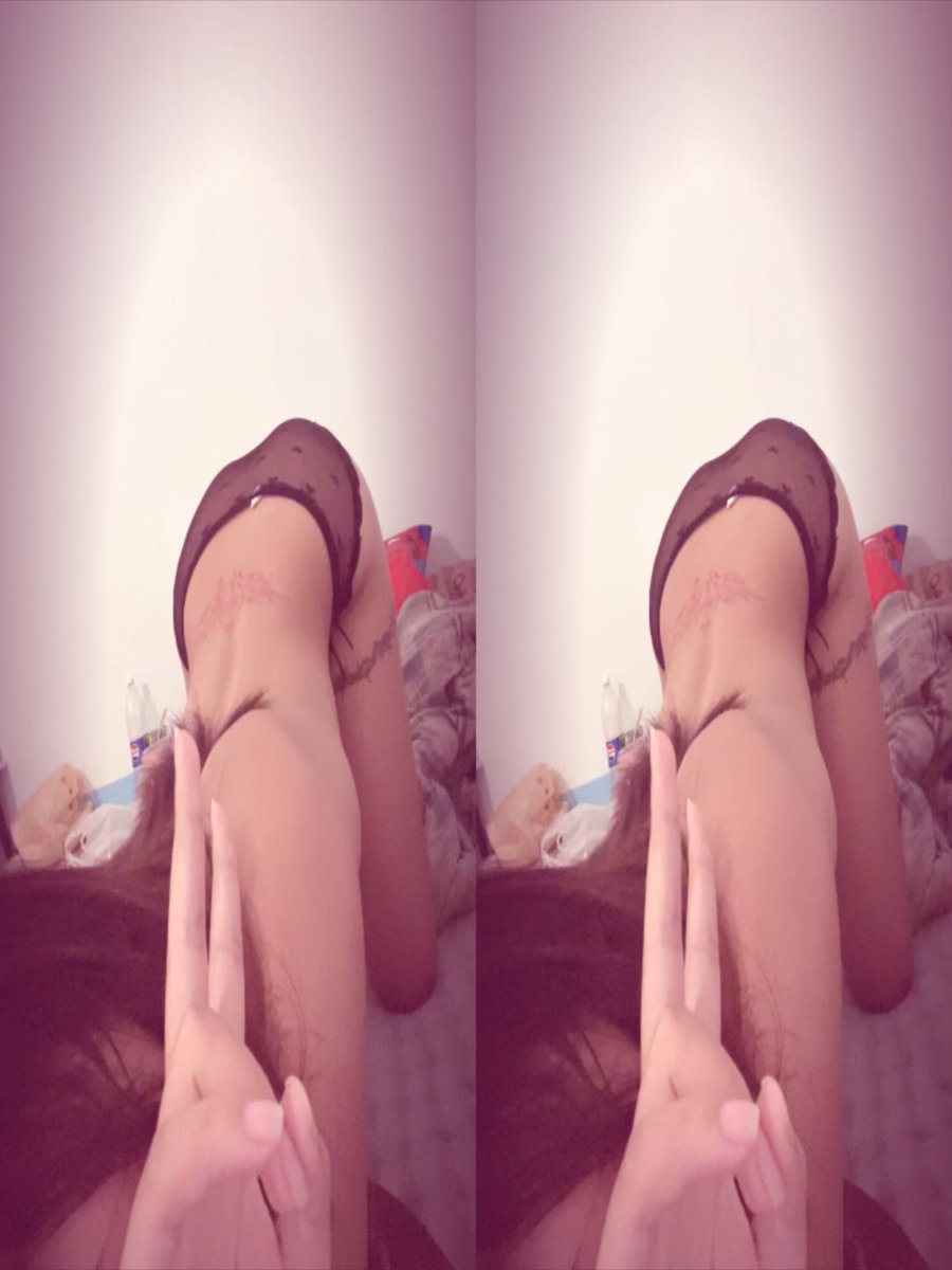 YUJIyuji008's tweet photo. แผลเต็มตัวเลยจะบ้า😰 #สกลนคร #fwb #เมืองสกลนคร https://t.co/GkzEGgi6n8