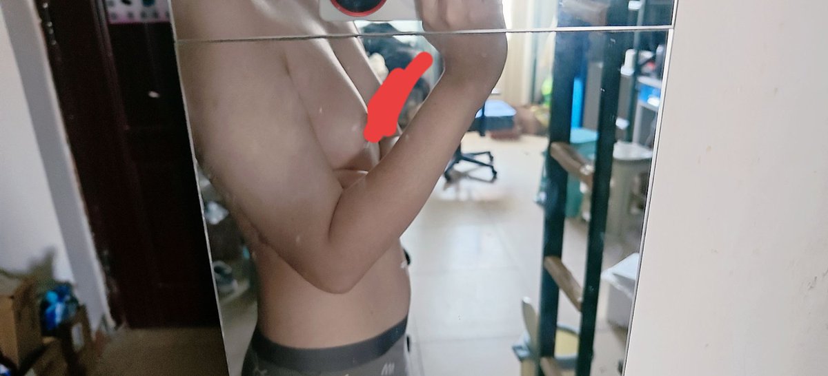 mm2527681052935's tweet photo. #mtf  #木桶饭 #药娘 接近放假回家快要接受审判了（山东家庭）已经瞒不���了😥（hrt一年） https://t.co/cW63fIspFM