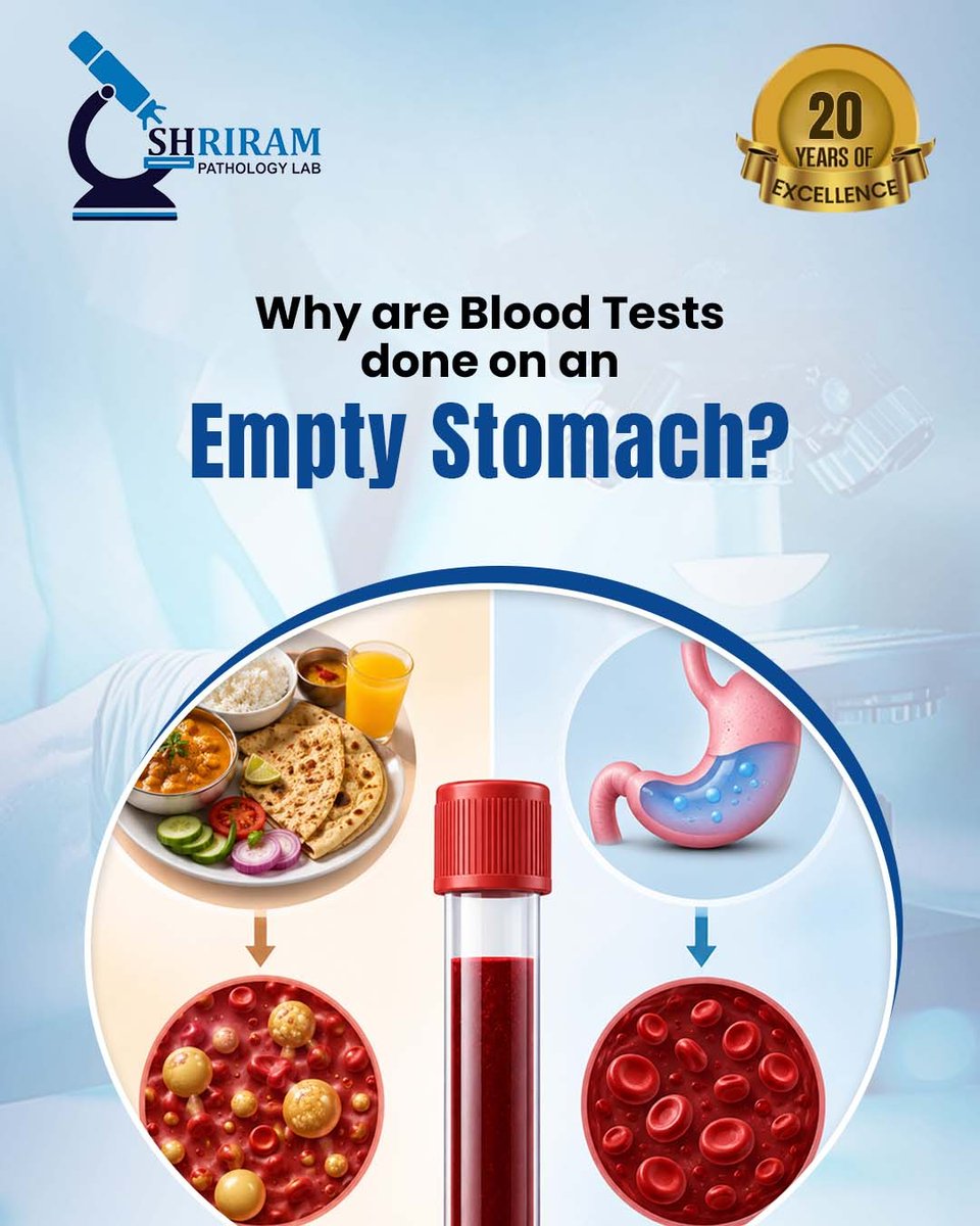 Shrirampatholo1's tweet photo. Fasting before certain blood tests helps deliver more accurate and reliable results.
A simple step like an empty stomach can make a big difference in your diagnosis.
#BloodTest #shrirampathologylab #HealthCheckup #DiagnosticCare #PreventiveHealthcare https://t.co/KjtRZLcCWH