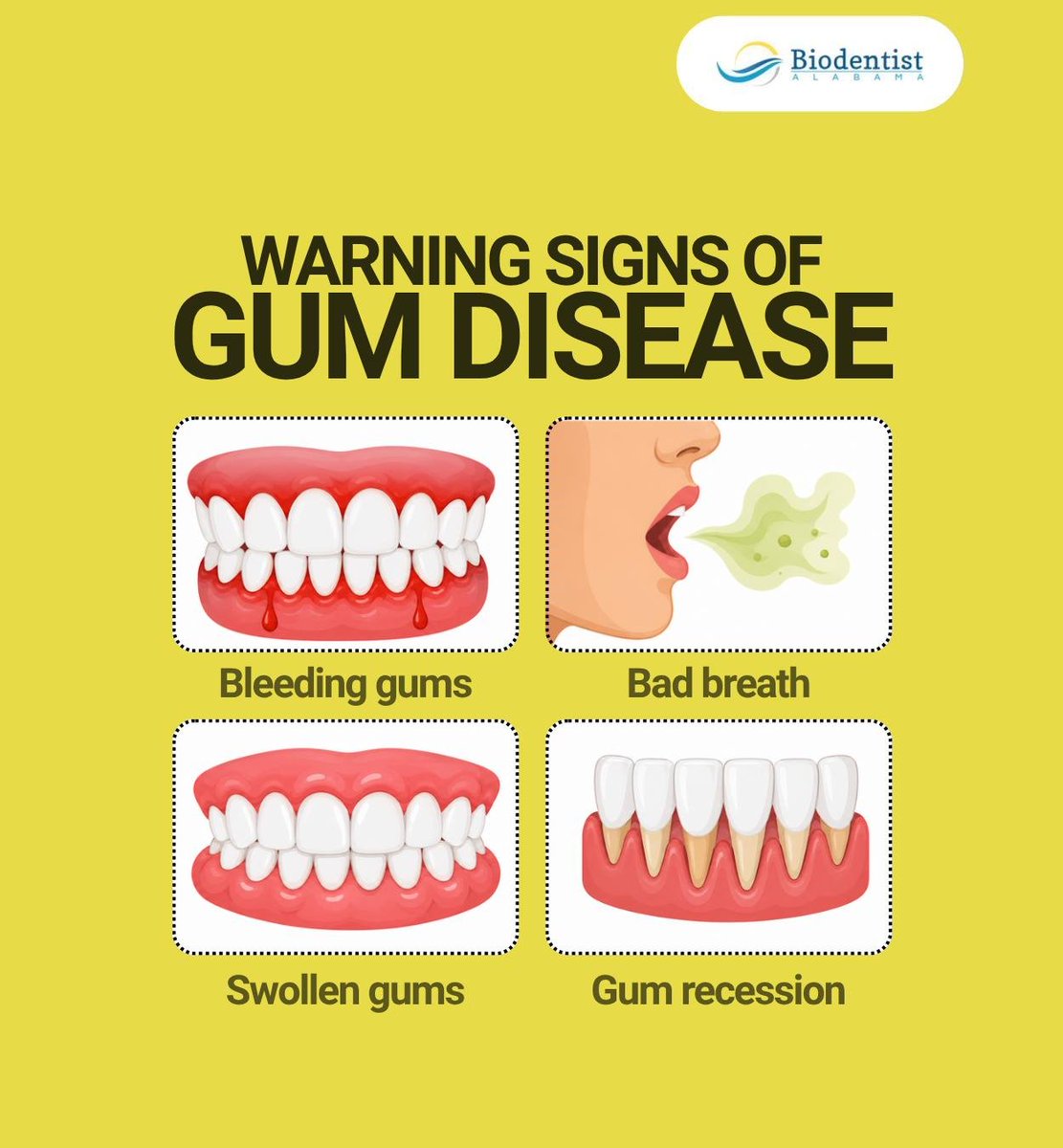BiodentistAL's tweet photo. Gum disease can affect your overall health, as it has been linked to health conditions like diabetes and heart disease. Take care of your gums for better oral and overall health.

#gumdisease #gumhealth #systemichealth #dothan #AL #biodentistalabama https://t.co/MPBxOhiHCD