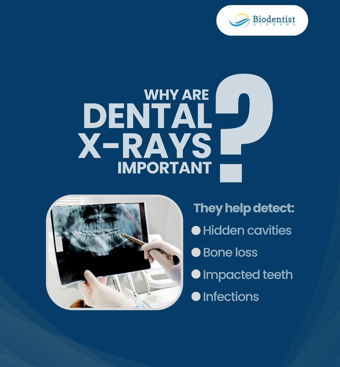 BiodentistAL's tweet photo. Dental X-rays help dentists examine parts of your mouth that aren't visible to the naked eye during a regular exam. This includes nerves, the jawbone, and tooth roots.

#dentalxrays #dentistry #dentist #dothan #AL #biodentistalabama https://t.co/T5MgQvquLI