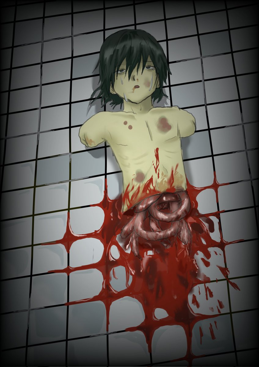 cy_plz's tweet photo. 両腕 下半身欠損 ハラキリ
根性焼き アザ 死亡 https://t.co/gssm3wqmdt