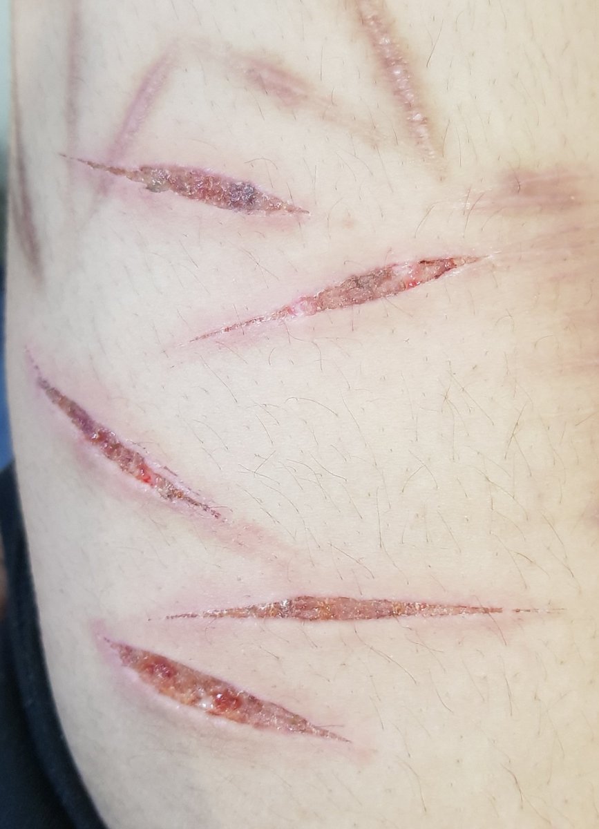 _splatterpunk's tweet photo. ai generated some nasty ass beans https://t.co/eWlOsayEbj