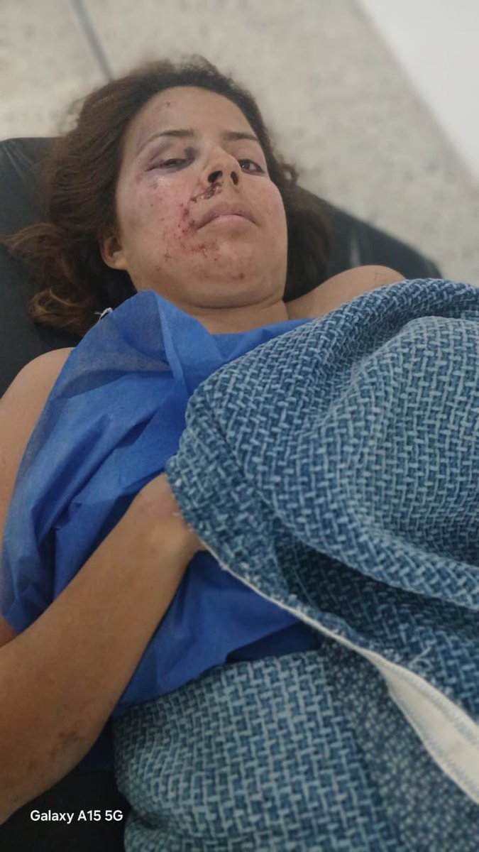 cr_vasquez's tweet photo. Como muchas familias venezolanas, Mariana Pulido de Reverón y su hijo, Gael Reverón, lo perdieron absolutamente todo. En estos momentos se encuentran hospitalizados en el Hospital Central de Valencia. Hoy solo cuentan con la ropa que llevaban puesta al momento de ser rescatados, después de permanecer 26 horas tapiados y enterrados vivos bajo los escombros durante la tragedia ocurrida en Vargas.

Para hacer aún más dolorosa esta situación, el jefe del hogar, el comisario Jesús Reverón, únicamente conserva el uniforme de la cárcel, donde permanece privado de libertad por un delito que asegura no haber cometido, en un caso relacionado con el presunto secuestro de la hija de Nicolás Maduro Guerra (Nicolasito).

En este momento de angustia, solicitamos el apoyo y la solidaridad de todos. Puedes colaborar realizando un donativo o compartiendo esta publicación. Toda ayuda, por pequeña que sea, puede marcar una gran diferencia para esta familia que hoy atraviesa una de las pruebas más difíciles de su vida.

https://t.co/lSI4LUxvbA