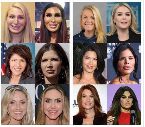 smc429's tweet photo. It's as if they had plastic surgery to ruin their looks. https://t.co/oKoZcC7zkM